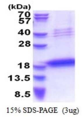 SDS-PAGE: Recombinant Human Chondromodulin-1/LECT1 His Protein [NBP2-51539]