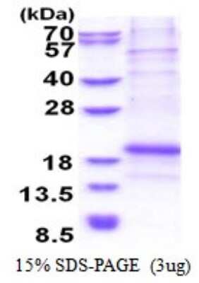 SDS-PAGE: Recombinant Human Chondromodulin-1/LECT1 His Protein [NBP2-51552]