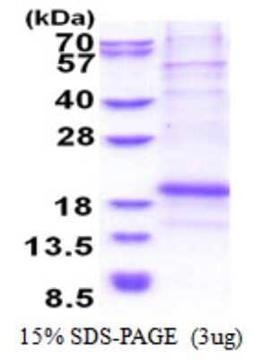 SDS-PAGE: Recombinant Human Chondromodulin-1/LECT1 His Protein [NBP2-51552]