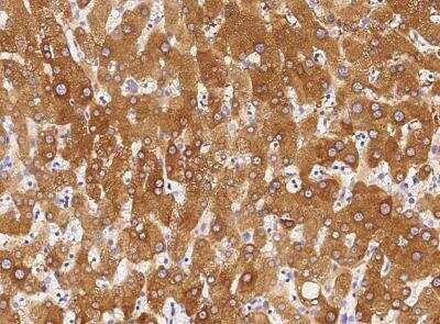 Immunohistochemistry-Paraffin: Chordin Antibody (065) [NBP2-89221]