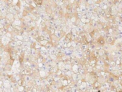 Immunohistochemistry-Paraffin: Chordin Antibody (065) [NBP2-89221]