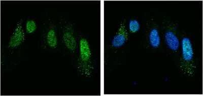 Immunocytochemistry/ Immunofluorescence: Chordin Antibody [NBP2-98689]