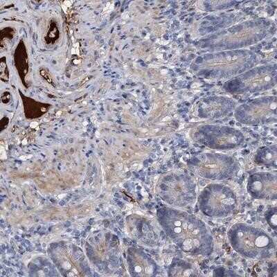 Immunohistochemistry-Paraffin: Chordin Antibody [NBP1-87513]