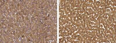 Immunohistochemistry-Paraffin: Chordin Antibody [NBP2-98688]