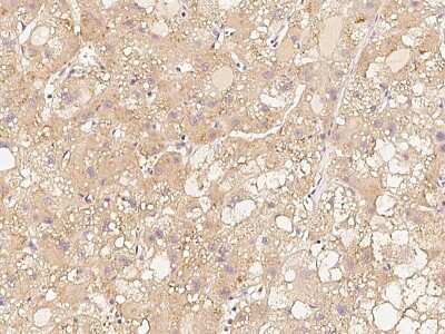 Immunohistochemistry-Paraffin: Chordin Antibody [NBP2-99454]