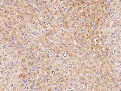 Immunohistochemistry-Paraffin: Chordin Antibody [NBP2-99454]