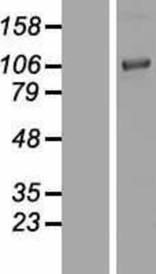 Western Blot: Chordin Overexpression Lysate [NBP2-10545]