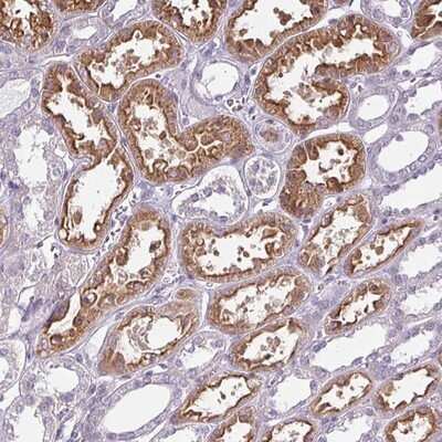 Immunohistochemistry-Paraffin: Chordin-like 1/CHRDL1 Antibody [NBP1-84485]