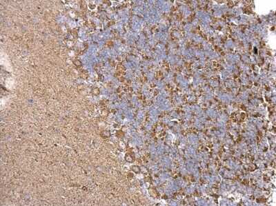 Immunohistochemistry-Paraffin: Chordin-like 1/CHRDL1 Antibody [NBP3-12874]