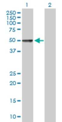 Western Blot: Chordin-like 1/CHRDL1 Antibody [H00091851-B01P]