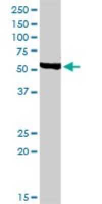 Western Blot: Chordin-like 1/CHRDL1 Antibody [H00091851-D01P]