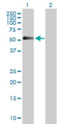 Western Blot: Chordin-like 1/CHRDL1 Antibody [H00091851-D01P]