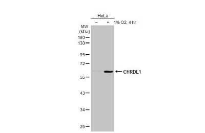 Western Blot: Chordin-like 1/CHRDL1 Antibody [NBP3-12874]