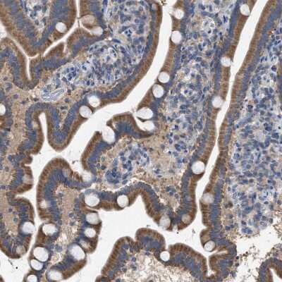 Immunohistochemistry-Paraffin: Chorein Antibody [NBP1-85641]