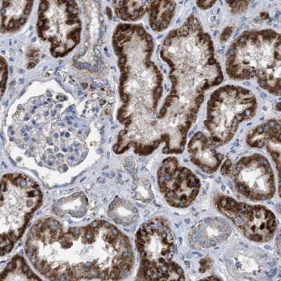 Immunohistochemistry-Paraffin: Chorein Antibody [NBP1-85641]