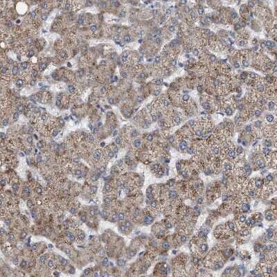 Immunohistochemistry-Paraffin: Chorein Antibody [NBP1-85641]