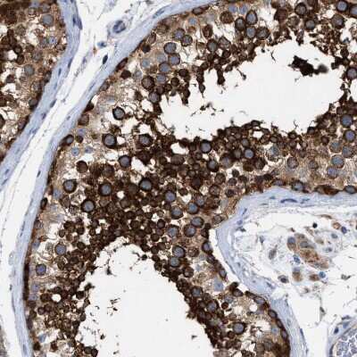 Immunohistochemistry-Paraffin: Chorein Antibody [NBP1-85641]