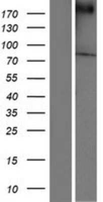 Western Blot: Chorein Overexpression Lysate [NBP2-05897]