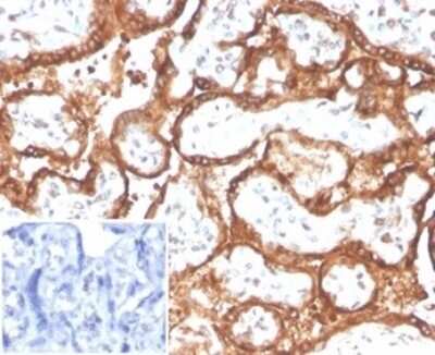 Immunohistochemistry-Paraffin: Chorionic Gonadotropin alpha Chain (hCG alpha) Antibody (HCGa/2728R) [NBP3-13844]