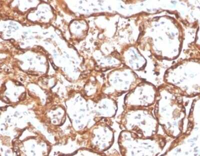 Immunohistochemistry-Paraffin: Chorionic Gonadotropin alpha Chain (hCG alpha) Antibody (HCGa/2728R) [NBP3-13844]