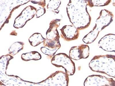 Immunohistochemistry-Paraffin: Chorionic Gonadotropin alpha Chain (hCG alpha) Antibody (HCGa/53) - Azide and BSA Free [NBP2-34630]