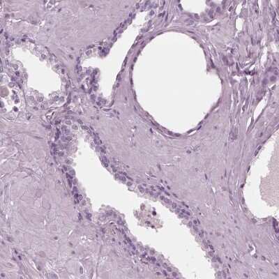 Immunohistochemistry-Paraffin: Chorionic Gonadotropin alpha Chain (hCG alpha) Antibody [NBP2-34183]