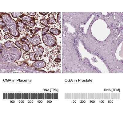 Immunohistochemistry-Paraffin: Chorionic Gonadotropin alpha Chain (hCG alpha) Antibody [NBP2-34183]