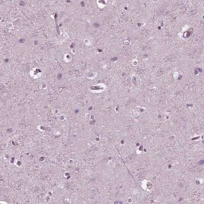 Immunohistochemistry-Paraffin: Chorionic Gonadotropin alpha Chain (hCG alpha) Antibody [NBP2-34183]