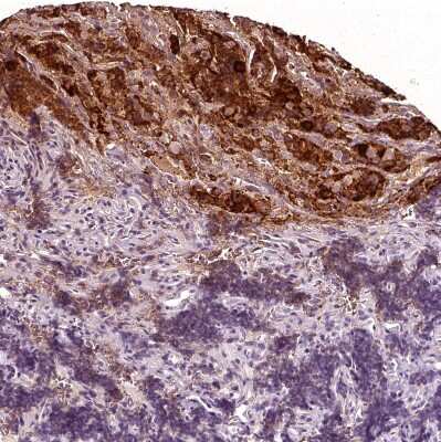 Immunohistochemistry-Paraffin: Chorionic Gonadotropin alpha Chain (hCG alpha) Antibody [NBP2-34183]