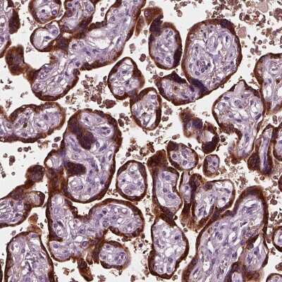 Immunohistochemistry-Paraffin: Chorionic Gonadotropin alpha Chain (hCG alpha) Antibody [NBP2-34183]