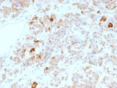 Immunohistochemistry-Paraffin: Chorionic Gonadotropin alpha Chain (hCG alpha) Antibody (LHa/756) [NBP2-53394]