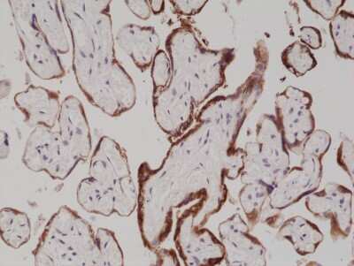 Immunohistochemistry: Chorionic Gonadotropin alpha Chain (hCG alpha) Antibody (RM330) [NBP2-77412]