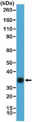 Western Blot: Chorionic Gonadotropin alpha Chain (hCG alpha) Antibody (RM330) [NBP2-77412]