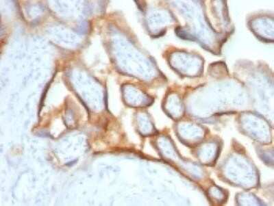 Immunohistochemistry-Paraffin: Chorionic Gonadotropin alpha Chain (hCG alpha) Antibody (SPM552) - Azide and BSA Free [NBP2-34794]