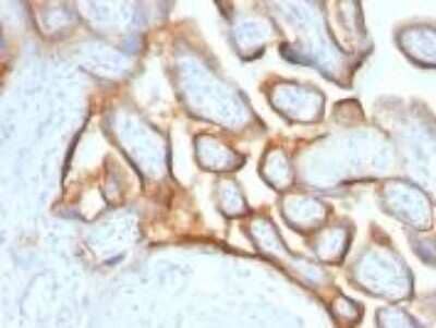 Immunohistochemistry-Paraffin: Chorionic Gonadotropin alpha Chain (hCG alpha) Antibody (SPM552) [NBP2-32971]