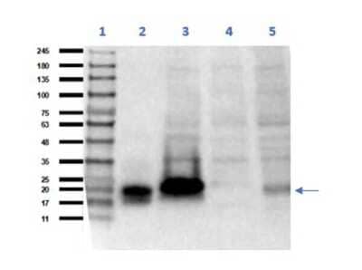 Western Blot: Chorionic Gonadotropin alpha Chain (hCG alpha) Antibody [NBP3-18630]