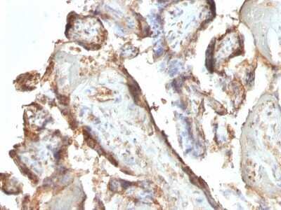 Immunohistochemistry-Paraffin: Chorionic Gonadotropin alpha/beta (hCG) Antibody (HCGab/52) [NBP2-45334]