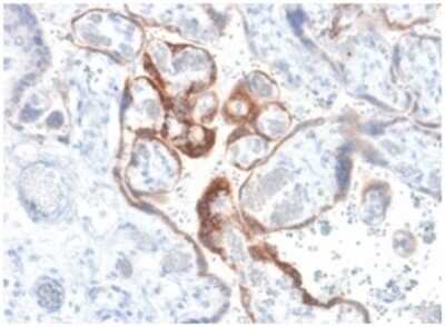Immunohistochemistry-Paraffin: Chorionic Gonadotropin beta Chain (hCG beta) Antibody (HCGb/1985R) - Azide and BSA Free [NBP3-08820]