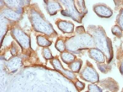 Immunohistochemistry-Paraffin: Chorionic Gonadotropin beta Chain (hCG beta) Antibody (HCGb/54+ HCGb/459) - Azide and BSA Free [NBP2-34632]