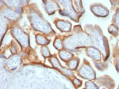 Immunohistochemistry-Paraffin: Chorionic Gonadotropin beta Chain (hCG beta) Antibody (HCGb/54+ HCGb/459) [NBP2-34238]