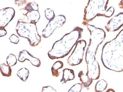 Immunohistochemistry-Paraffin: Chorionic Gonadotropin beta Chain (hCG beta) Antibody (HCGb/54) - Azide and BSA Free [NBP2-33110]