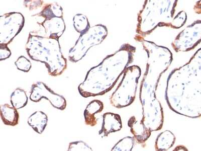 Immunohistochemistry-Paraffin: Chorionic Gonadotropin beta Chain (hCG beta) Antibody (HCGb/54) [NBP2-22392]