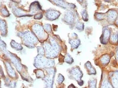 Immunohistochemistry-Paraffin: Chorionic Gonadotropin beta Chain (hCG beta) Antibody (SPM105) - Azide and BSA Free [NBP2-34392]