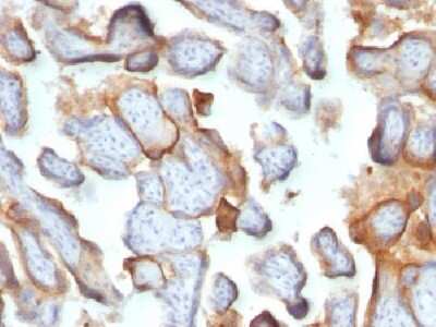 Immunohistochemistry-Paraffin: Chorionic Gonadotropin beta Chain (hCG beta) Antibody (SPM105) [NBP2-34345]