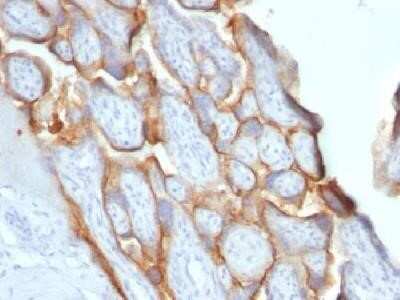 Immunohistochemistry-Paraffin: Chorionic Gonadotropin beta Chain (hCG beta) Antibody (SPM529) - Azide and BSA Free [NBP2-34416]