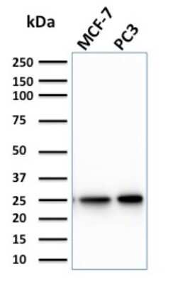 Western Blot: Chp2 Antibody (CPTC-CHP2-1)Azide and BSA Free [NBP3-08694]