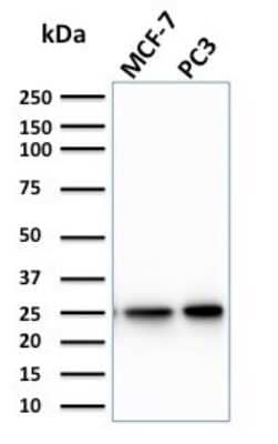 Western Blot: Chp2 Antibody (CPTC-CHP2-1) [NBP3-07819]