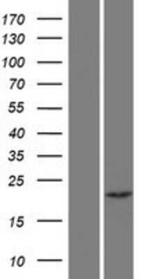 Western Blot: Chp2 Overexpression Lysate [NBP2-06467]