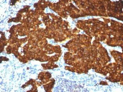 Immunohistochemistry-Paraffin: Chromogranin A Antibody (CGA/413 + CHGA/777 + CHGA/798) - Azide and BSA Free [NBP2-47846]