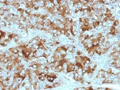 Immunohistochemistry-Paraffin: Chromogranin A Antibody (CGA/413 + CHGA/777 + CHGA/798) - Azide and BSA Free [NBP2-47846]